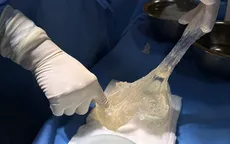 Vỡ túi ngực âm thầm chị em cần lưu ý