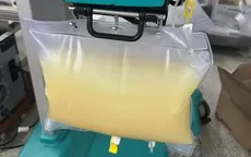 Nguy kịch vì viêm tụy cấp thể hoại tử nặng