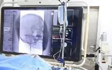 Đột quỵ ở người trẻ gia tăng: Đừng chủ quan với cơn đau đầu bất thường