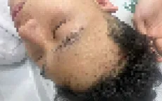 Nam sinh nhập viện sau vụ bị hành hung trong đêm ở Hà Nội