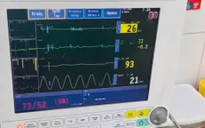 Đặt máy tạo nhịp tạm thời, cứu sống bệnh nhân tim chỉ còn 26 chu kỳ/phút