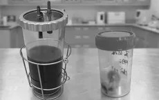 Cấp cứu thai ngoài tử cung vỡ, bệnh nhân mất 2.000ml máu