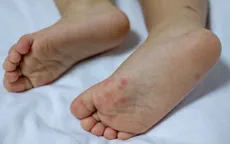 Những sai lầm trong điều trị tay chân miệng cho trẻ