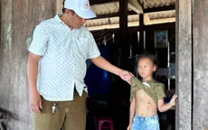 Đắk Lắk: Khẩn trương khoanh vùng ổ dịch thuỷ đậu trong trường tiểu học