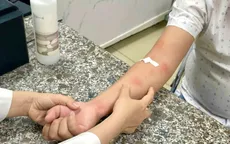 Cảnh báo nhiễm giun sán chó mèo gây bệnh da liễu