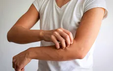 Ngứa kéo dài có thể là dấu hiệu suy thận