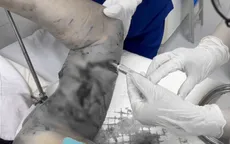 Chó nhà bất ngờ tấn công chủ, nguy cơ bệnh dại không thể chủ quan