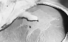 Áp xe nặng sau khi tự đắp thuốc lá