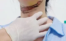 Đi xe máy điện, nữ sinh gặp nạn vì dây điện giăng ngang đường