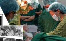 Bóc thành công khối u xơ kích thước lớn, bảo tồn tử cung cho người phụ nữ 34 tuổi