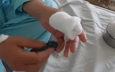 Cảnh báo rắn chàm quạp mùa thu hoạch điều: 36 ca nhập viện từ đầu năm