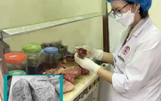 Phẫu thuật thành công khối u tử cung nặng 5kg cho người bệnh