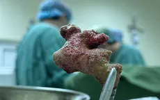 Sốc nhiễm trùng đường tiết niệu do sỏi - biến chứng nguy hiểm không nên chủ quan