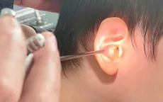 Viêm tai giữa suýt khiến nam bệnh nhân mất thính lực