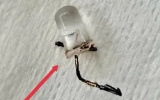Bóng đèn LED mắc kẹt trong... phế quản bé 9 tháng tuổi 