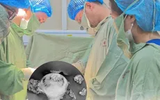 Chủ quan với rong kinh kéo dài, người phụ nữ phải nhập viện phẫu thuật