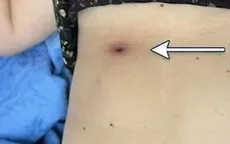 Cẩn trọng với sốt mò