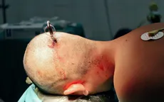 Cảnh báo tai nạn học đường nguy hiểm