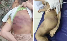 Công an vào cuộc vụ bé gái 2 tuổi bị  bạo hành đa chấn thương