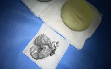 Nâng ngực 4 năm, phát hiện "dị vật" bất ngờ trong ngực