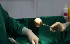 Tiểu buốt kéo dài, nhiều bệnh nhân mang sỏi bàng quang "khổng lồ" nhập viện