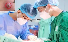 Vết thương nhỏ do dị vật đâm xuyên có thể gây áp xe, hoại tử