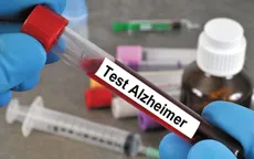 Mỹ phát triển phương pháp xét nghiệm máu giúp phát hiện sớm bệnh Alzheimer