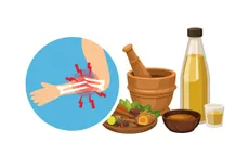 Không tự ý bó thuốc nam điều trị gãy xương