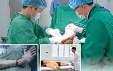 Cứu bàn chân suýt đứt rời sau tai nạn giao thông