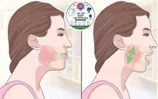 Nguy hiểm cơn đau hàm mặt kéo dài