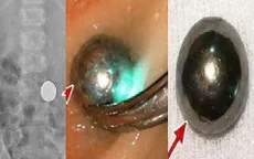 Đừng chủ quan với đồ chơi bi nam châm