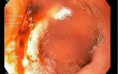 Nguy hiểm khi tự ý dùng lại đơn thuốc cũ