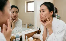 Những vitamin, khoáng chất nào tốt cho da mụn?