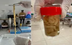 Gắp thành công sán dây bò dài 1,2 mét từ ruột người bệnh