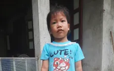 Hơn 20 triệu đồng và hy vọng sống khỏe của bé Tuệ Nhi