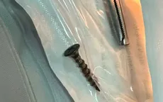 Bé 3 tháng tuổi nguy kịch vì hít phải đinh vít dài 4cm