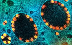 Mỹ lần đầu phê duyệt vaccine cúm mùa ứng dụng công nghệ mRNA