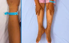Cảnh giác với nguy cơ tổn thương gan do tự ý sử dụng thuốc nam 