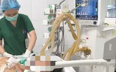 Cảnh báo viêm mô bào hoại tử từ những vết xước nhỏ
