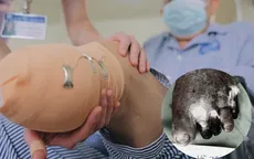 Ngâm nước nóng, người bệnh đái tháo đường phải đoạn chi