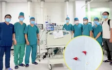 Trẻ bị suy hô hấp nặng vì 3 mảnh xương lươn mắc trong phế quản
