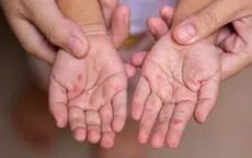 Chủ động phòng bệnh tay chân miệng 