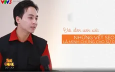 Anh tài Phùng Minh Cương: "Mỗi vết sẹo là minh chứng cho nỗ lực của nghệ sĩ xiếc"