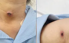 Sốt cao kéo dài, đừng bỏ qua một tổn thương nhỏ trên da