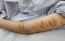 Đừng bỏ qua dấu hiệu khủng hoảng tâm lý ở trẻ vị thành niên