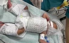 Cần Thơ: Lần đầu triển khai kỹ thuật hạ thân nhiệt cứu trẻ sơ sinh tổn thương não