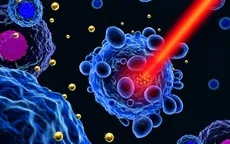 Israel: Phương pháp hạt nano mở hướng nghiên cứu mới trong điều trị ung thư