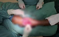 Cứu chi cho ngư dân bị chấn thương do cáp tời trên biển