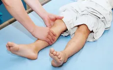 Cảnh giác với tiêu cơ vân cấp sau khi vận động gắng sức