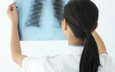 Nguy hiểm bệnh lao đa kháng thuốc